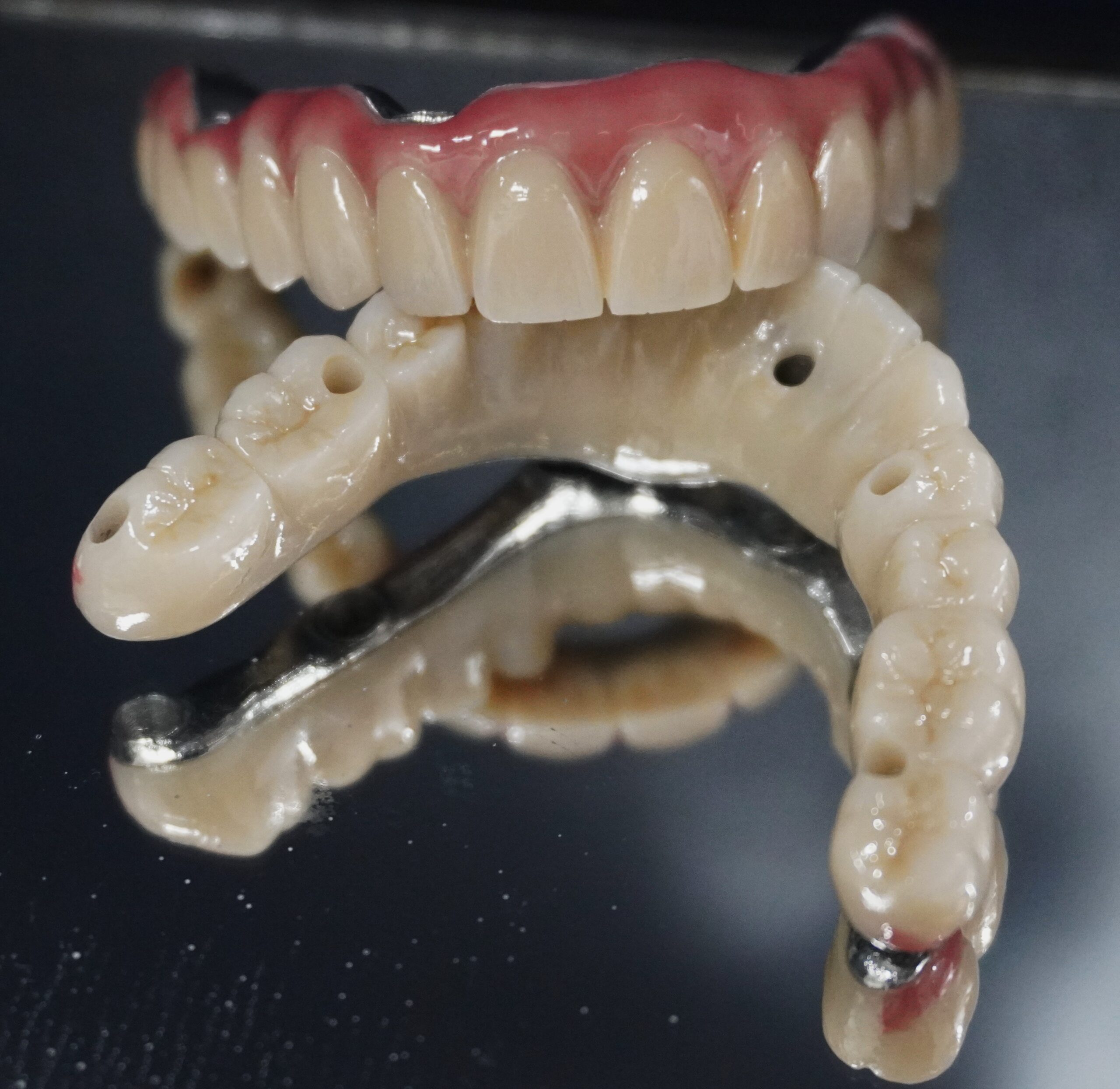 Fixed Teeth Case Study 6