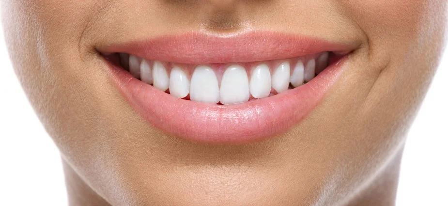 Beautification of Front Teeth
